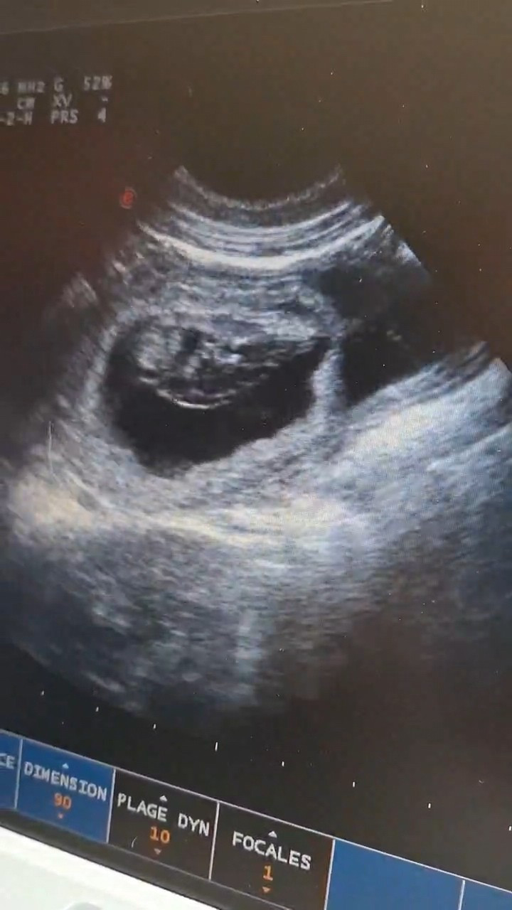 Gestation confirmée